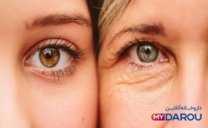 بهترین کرم دور چشم ایرانی